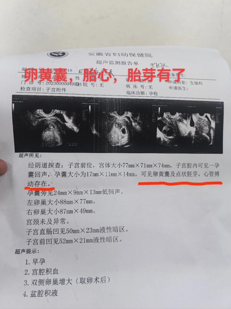 移植后积水