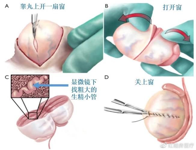 爸爸取精