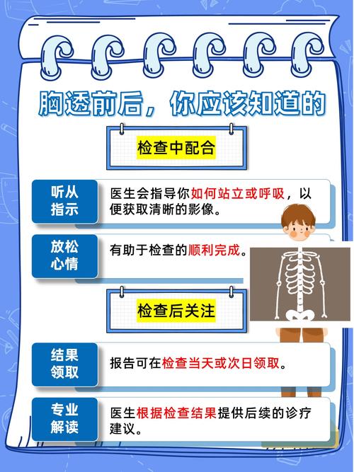 胸透注意事项