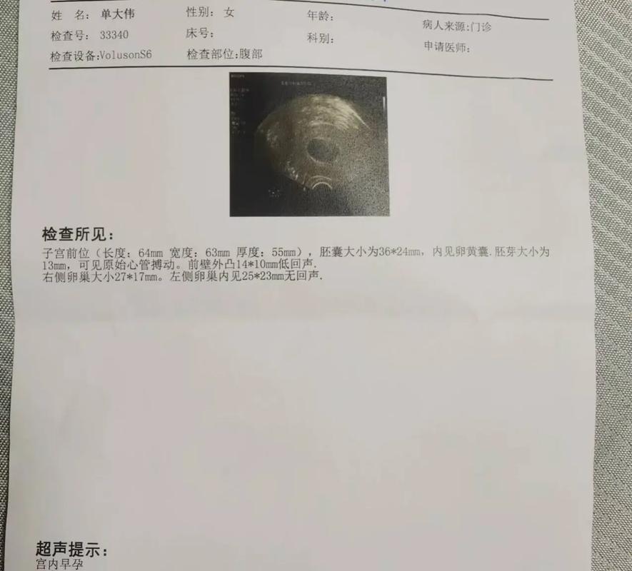 胎心胎芽检查
