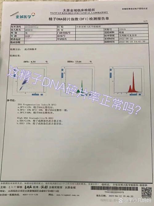 精子DNA碎片化检测