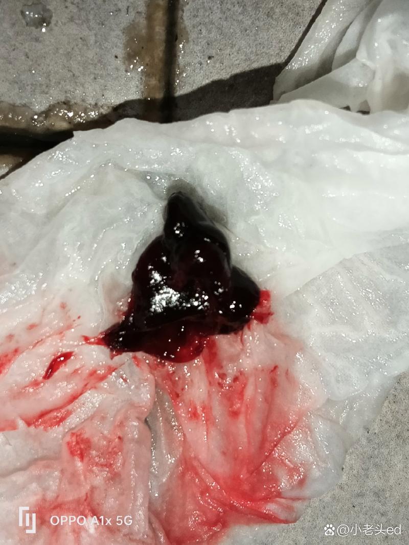  塞药流出