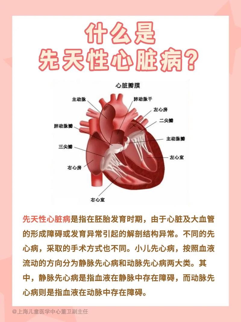 心脏病