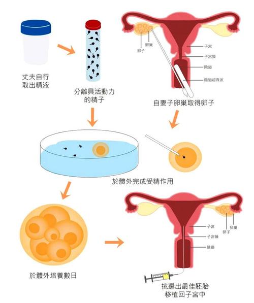 伦理思考
描述: 本文详细介绍了试管婴儿性别鉴定的技术、人们进行鉴定的原因、国内外法律规定、合法医学情况、选择机构注意事项及伦理思考等内容，帮助读者全面了解该技术并做出正确选择。