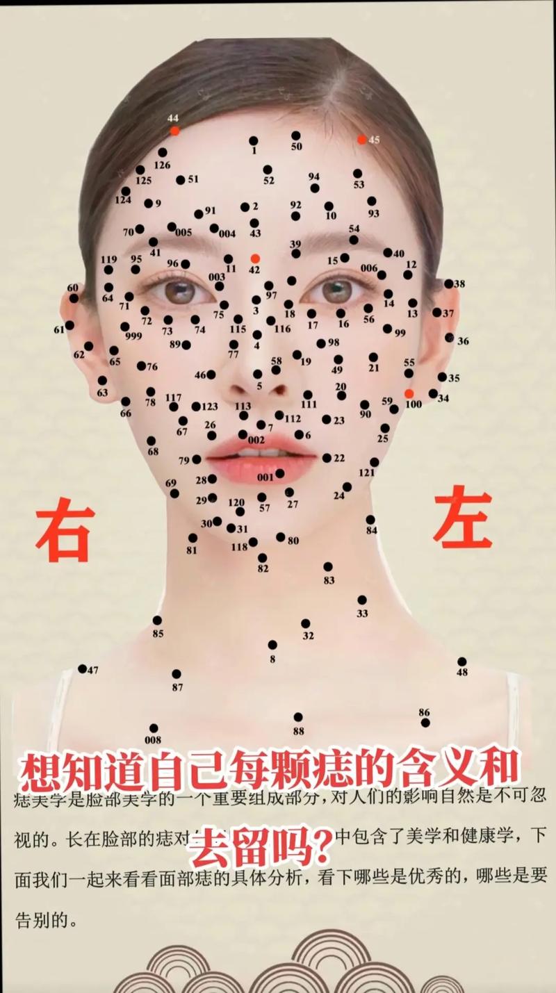 长痣