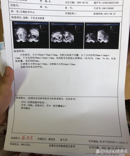 一超检查