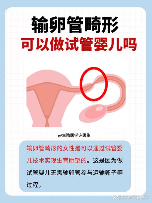 试管婴儿畸形会发生吗？真相解密!