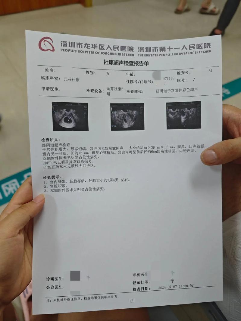 妊娠检查