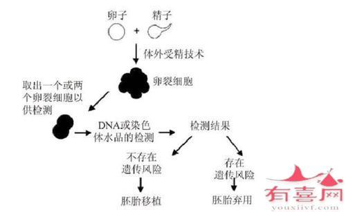 <胚胎植入前遗传学诊断>