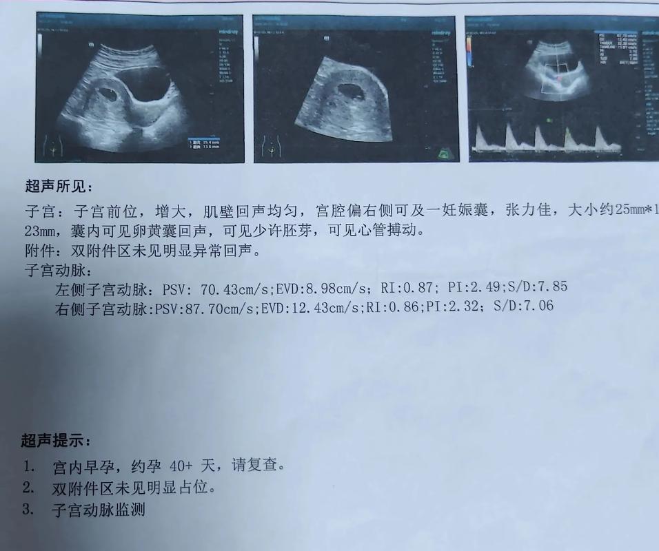 孕早期检查
