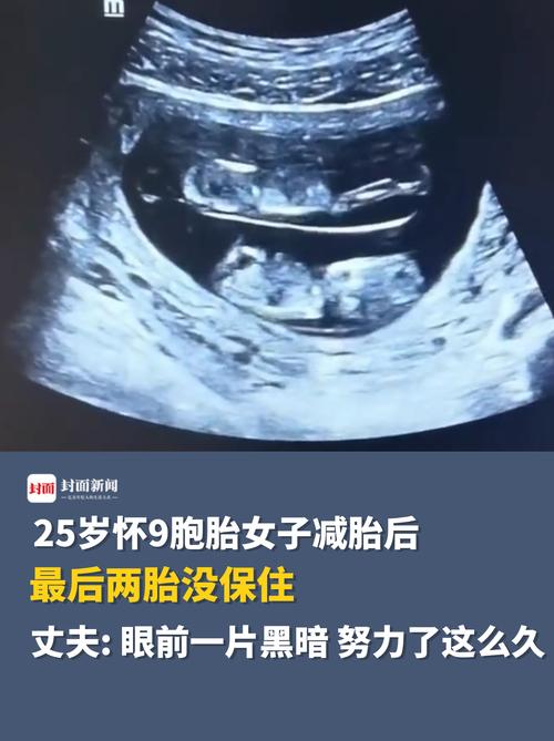 胚胎回放错误