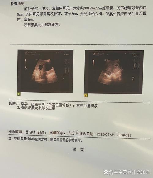 孕囊位置偏低