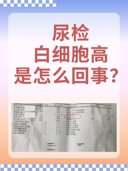 尿液白细胞检测