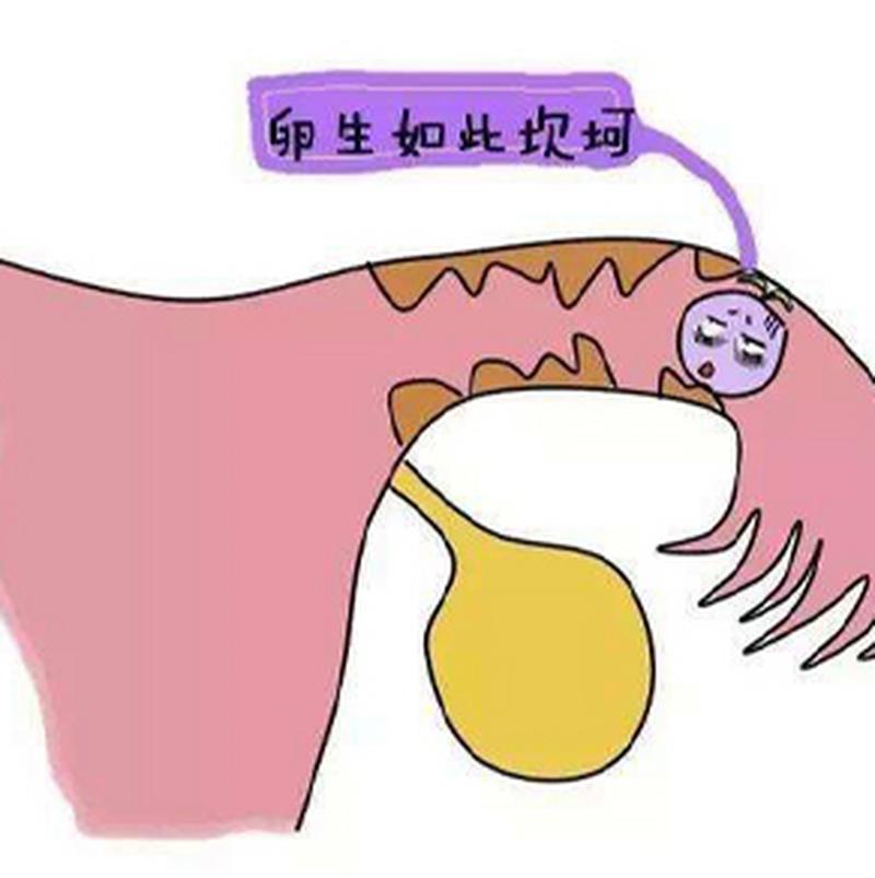 输卵管粘连