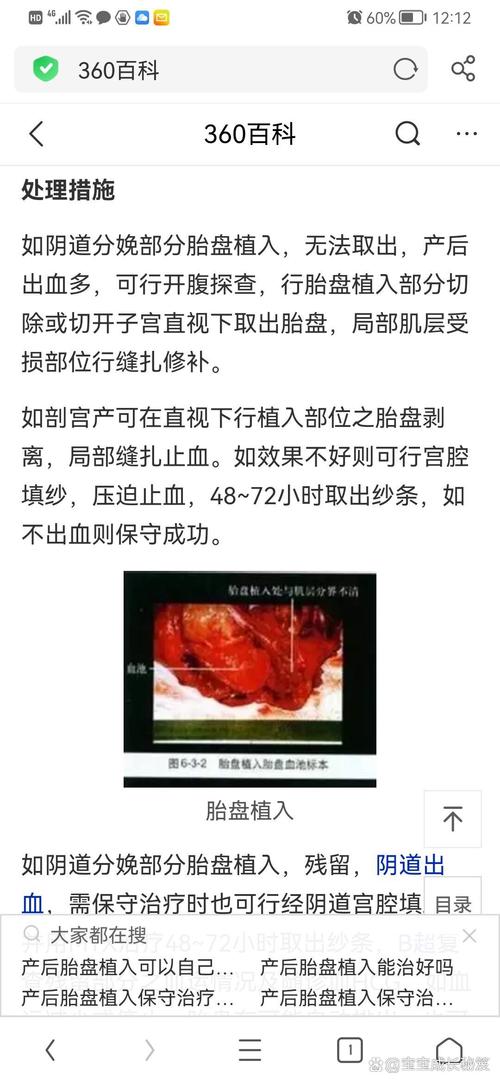  植入后天数计算