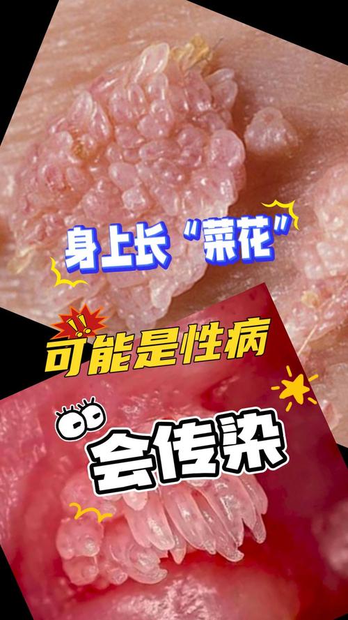 感染性病毒