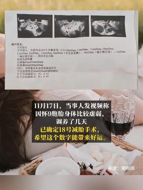 剪胎程序