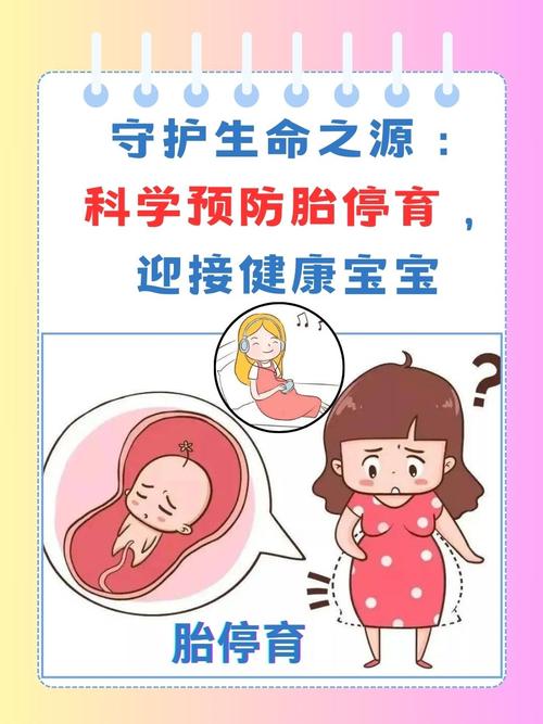 预防死胎