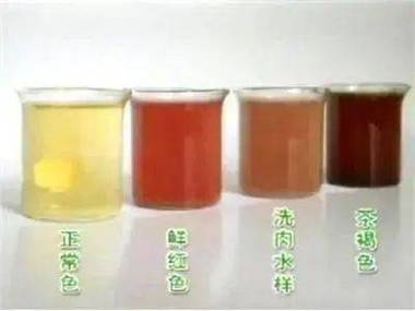  尿潜血