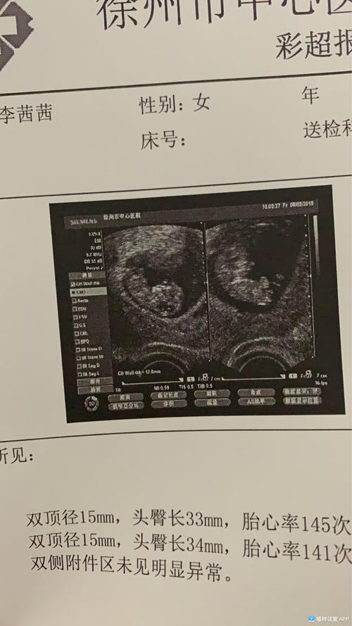 移植54天