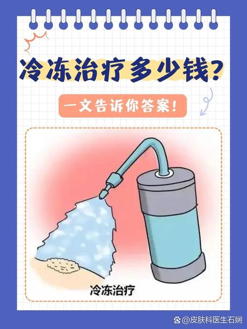 冷冻重要性