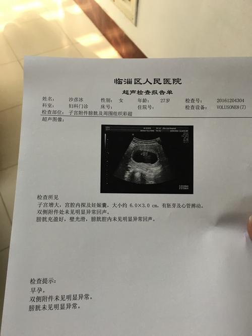 孕囊标准大小