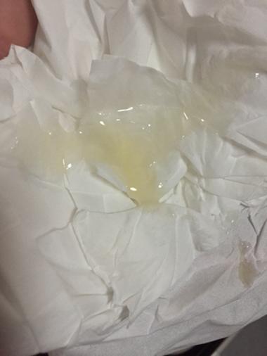 精液不液化