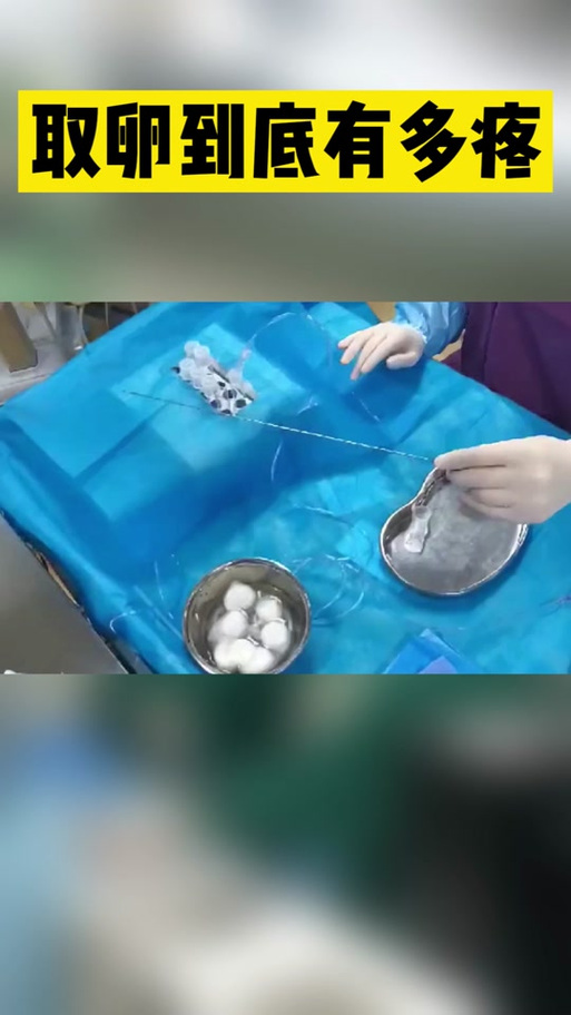  卵子提取