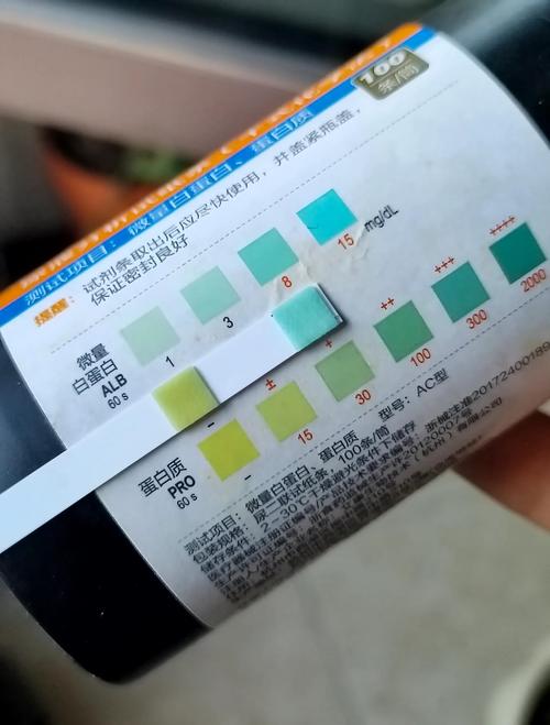 第三天验尿