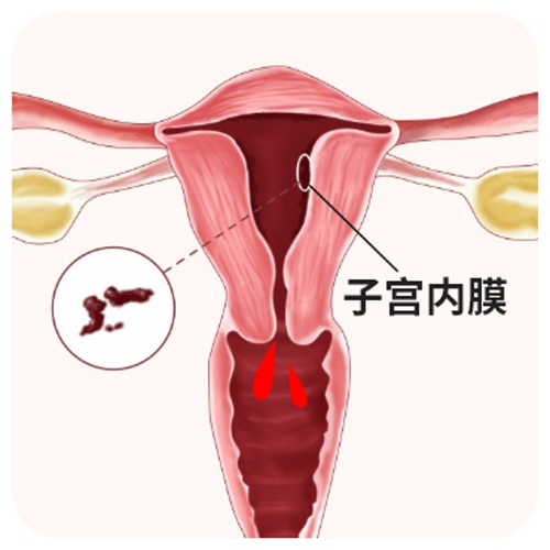 内膜形态