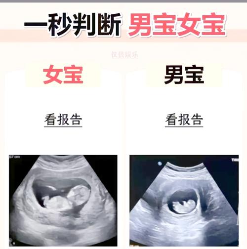  胚胎性别鉴定