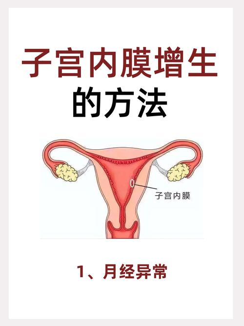 子宫结构异常