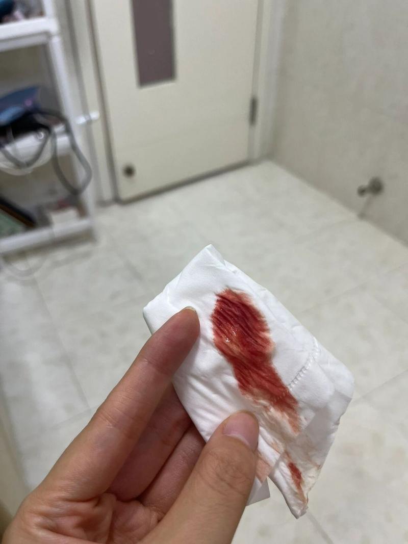 移植当天流血