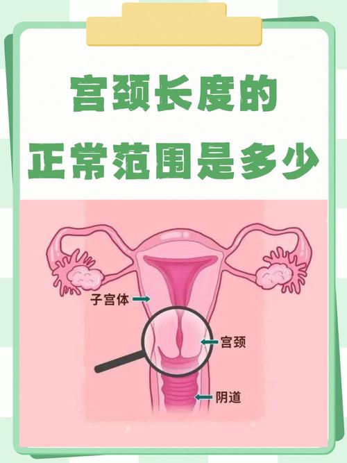  宫颈曲度大