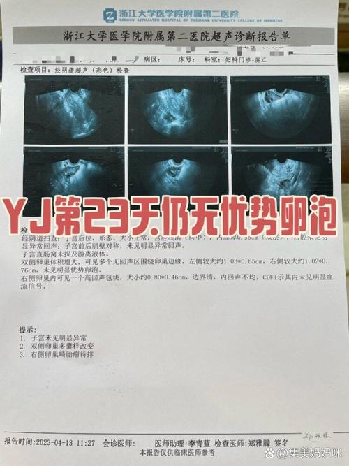 无卵泡