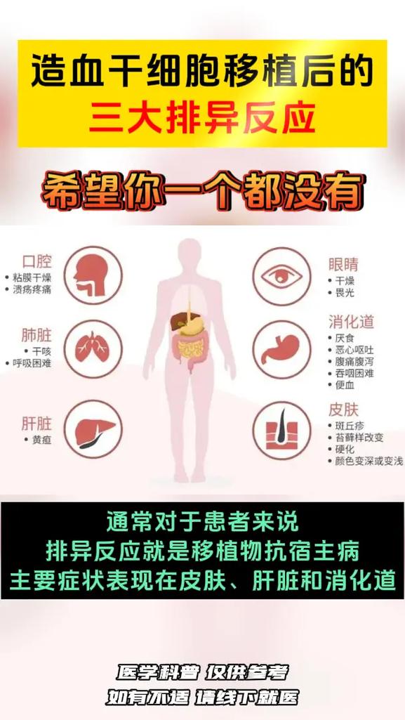 移植反应