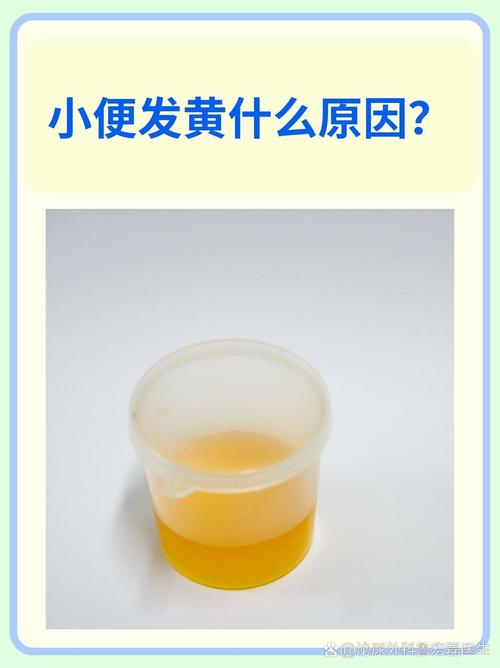 做完试管婴儿后小便发黄是否正常？