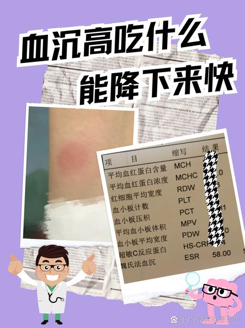 血沉指标