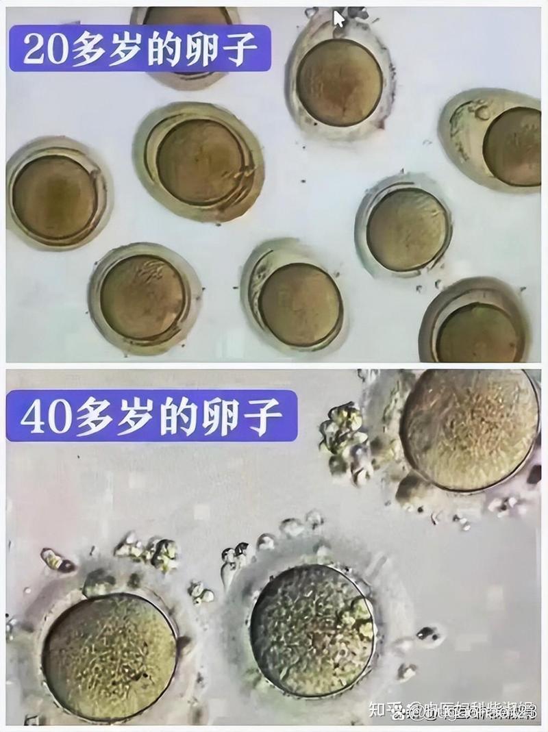 卵子2原核