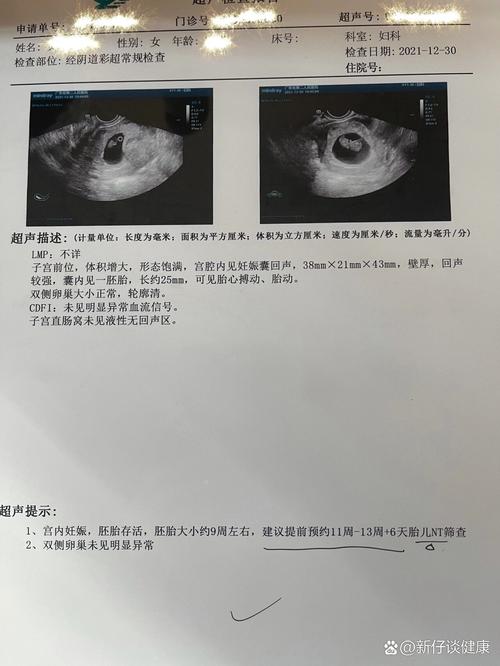 怀孕9周