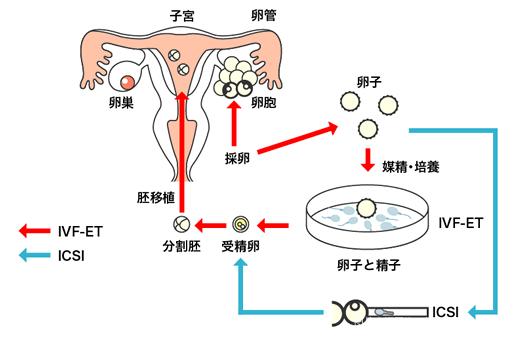 试管婴儿生化过程解析：难度几何？