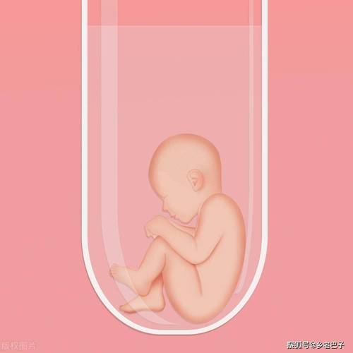 试管婴儿家庭如何正确养宠物？
