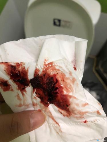 试管婴儿十几天出血：正常反应吗？