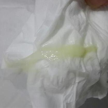 分泌物观察