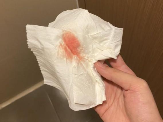 试管婴儿后出现少量出血正常吗？