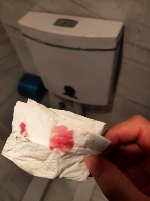 试管婴儿过程中会出现见红吗？