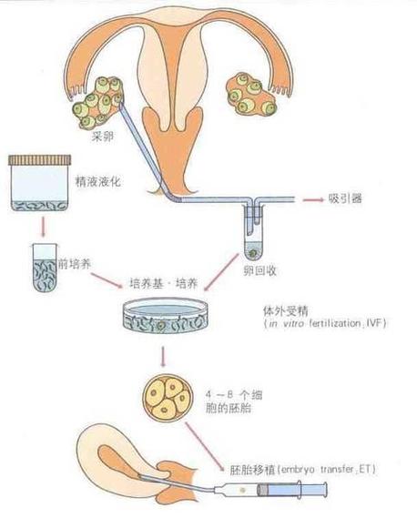 试管婴儿的囊胚培养流程是什么？