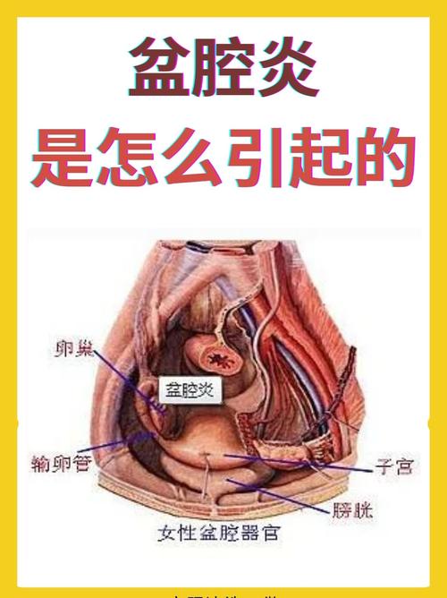 盆腔健康