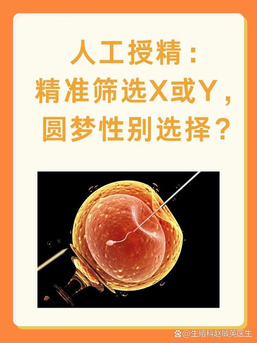 生殖选择