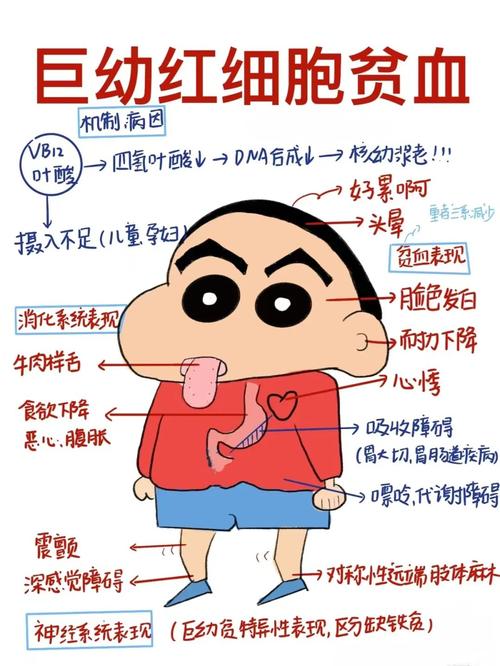 巨幼细胞贫血
